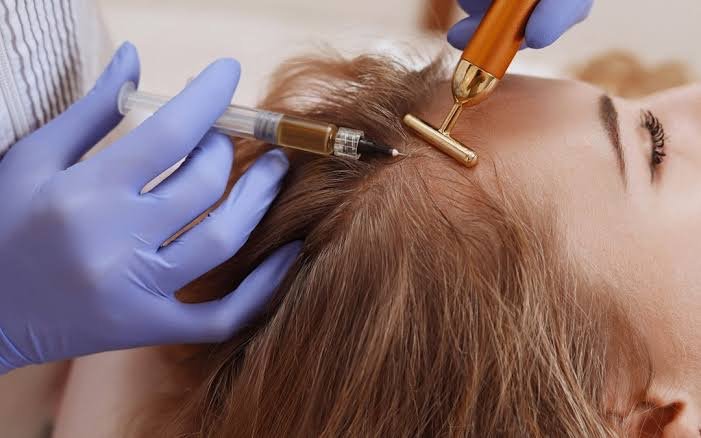 TTO Mesoterapia Capilar